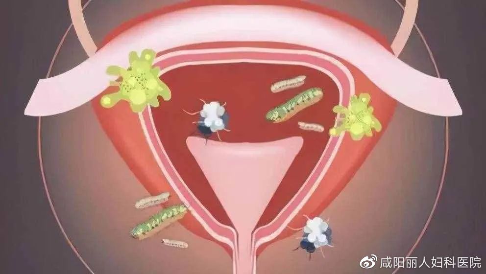 cea13f70ly4hc1j20ilnhj20rk0fk3zj cea13f70ly4hc1j20ilnhj20rk0fk3zj